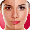 Face Blemishes Cleaner & Photo Scars Remover आइकन