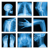 Medical X-Ray Interpretation आइकन